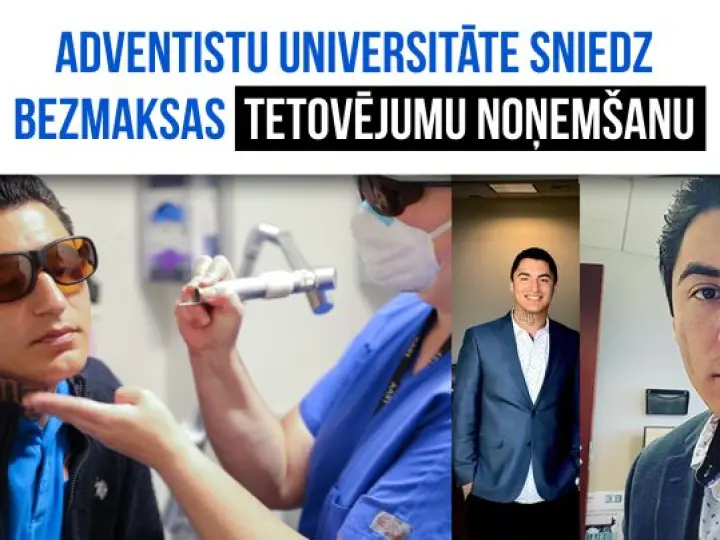 Loma Lindas universitāte izveidojusi tetovējumu noņemšanas programmu